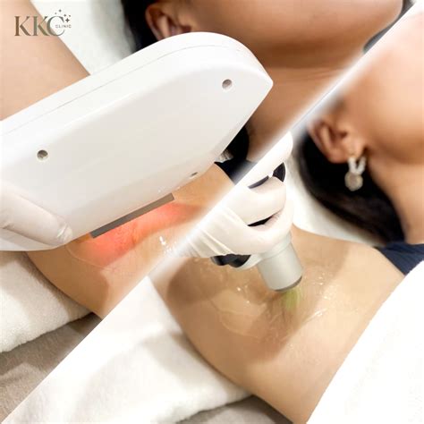 Laser Hair Removal in Bangkok: Effective for All Skin Types
