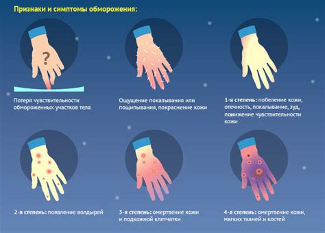 Первая помощь при обморожении