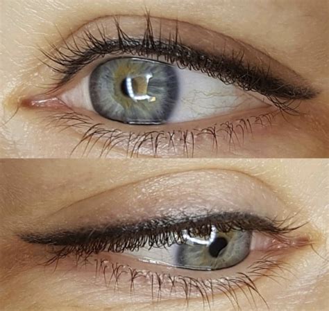 Permanent Makeup Eyeliner Before And After | Saubhaya Makeup