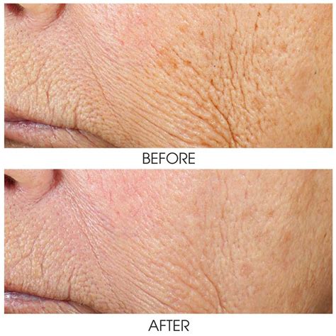 ZO Wrinkle + Texture Repair - Lébo Aesthetics & Spa