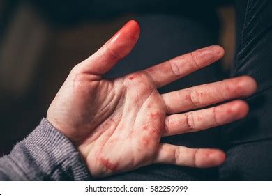 Bloody Hand Stock Photo 582259999 | Shutterstock
