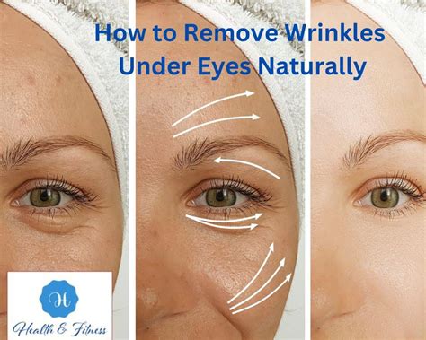 How To Remove Wrinkles Under Eyes Naturally: Expert Tips Unveiled
