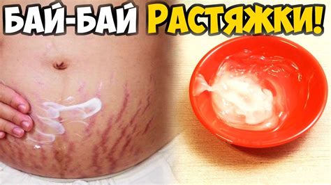 Реально работает, целлюлит исчез. Три сильнейших рецепта от целлюлита и ...