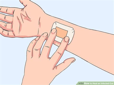 how to cure an infected cut at home