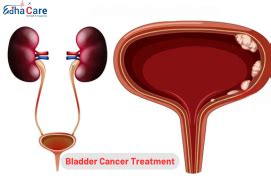 Bladder Cancer Treatment - Symptoms, Causes, Treatment Procedure