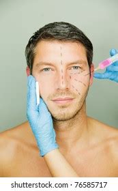 9,105 Face Plastic Surgery Man Images, Stock Photos & Vectors ...