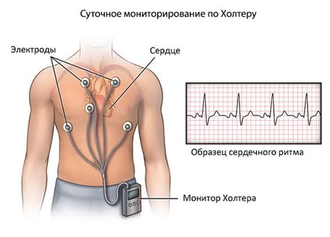 Учащённое сердцебиение, что делать? Причины, лекарства