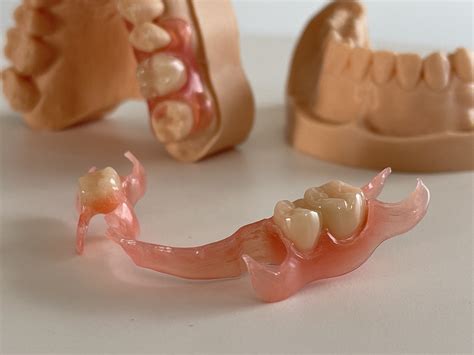 Replace Your Missing Teeth At-Home | ResetSmile