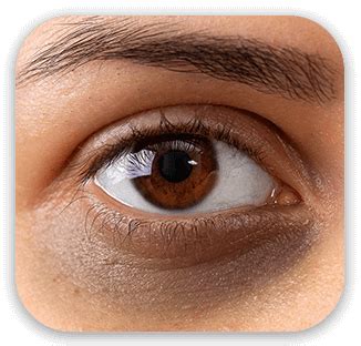 cosmetic eye surgery plastic eye surgery treatment  india