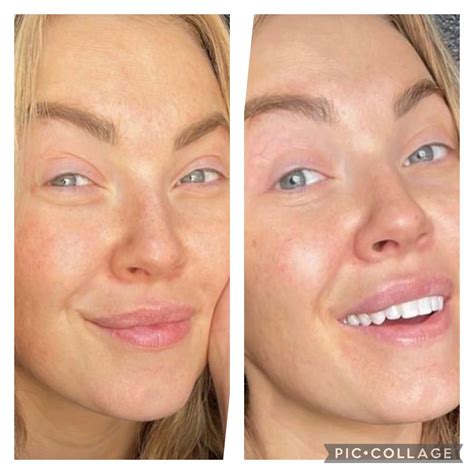 Compulsive lying is strong with this one. Even down to lying about