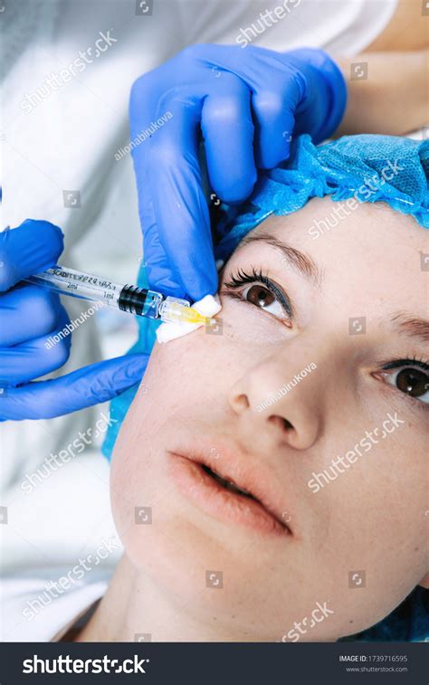 133 Mid Face Filler Injection Images, Stock Photos & Vectors | Shutterstock