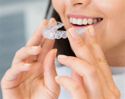 How Long Do I Have to Wear Invisalign? - Evergreen Dental