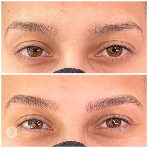 Sobrancelha Antes E Depois