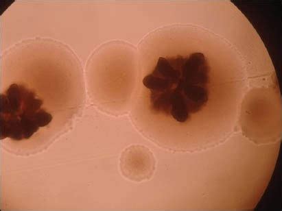 Aggregatibacter actinomycetemcomitans - Definition of Aggregatibacter actinomycetemcomitans