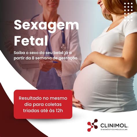 Com Quantas Semanas Pode Fazer A Sexagem - Sexagem Fetal – Clinimol