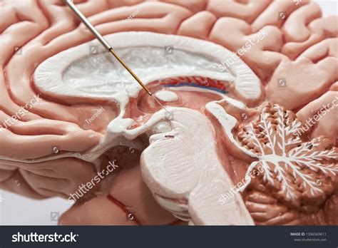 microelectrodes images stock  vectors shutterstock