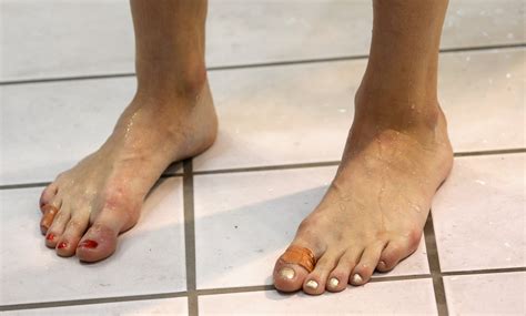 Can You Swim In A Pool With Toenail Fungus at Rose Hutchinson blog