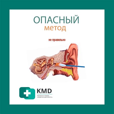 Удаление серных пробок 【Левый Берег】 Киев ~ Цены