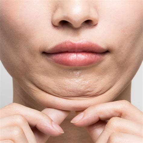 double chin illumia medical