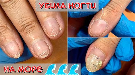 Отвалился гель лак - выжил только один ноготь😮 / Налипшая кутикула ...