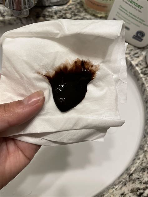 My roommate pulled out a huge blood clot from her nose : r/popping