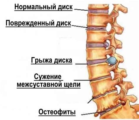 Боль в Пояснице: причины ️ Лечение поясничной боли в Киеве