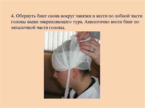 ПОВЯЗКА ЧЕПЕЦ техника наложения в картинках Повязка