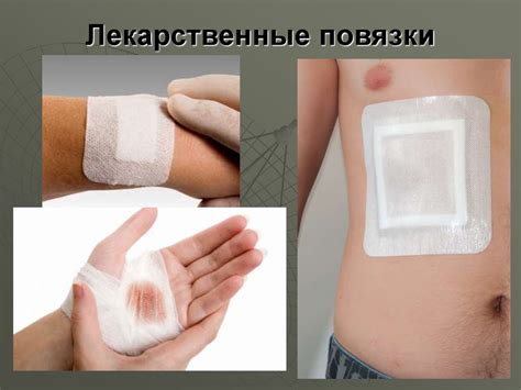 Первая помощь при кровотечениях (лекция 2) - презентация онлайн