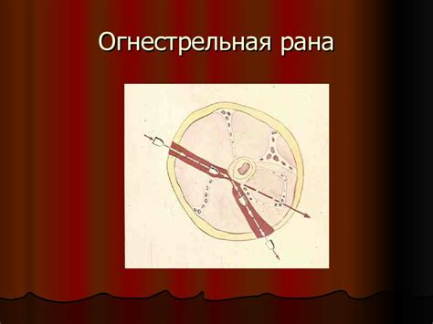 Огнестрельные ранения. Хирургическая обработка огнестрельных ран ...