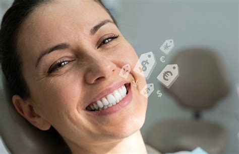 How Much Do Composite Veneers Cost? UK Price Guide 2025