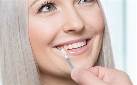 composite veneers london resin veneers cost uk  ps
