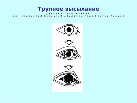Смерть и процесс умирания. (Лекция 3) - презентация онлайн