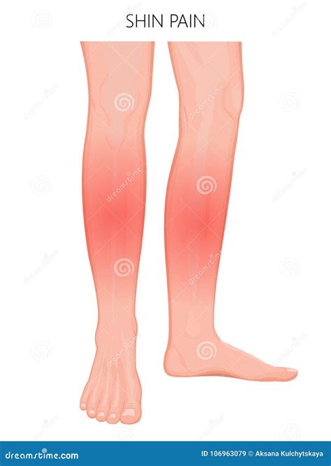 Shin Bone And Calf Bone Cartoon Vector | CartoonDealer.com #31308495