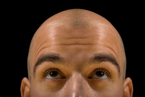 ScalpMasters explains how to reduce the shine on your bald head