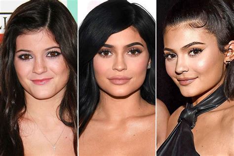 Kylie Jenner Says She's 'Never' Had Plastic Surgery, But Has Only Done ...