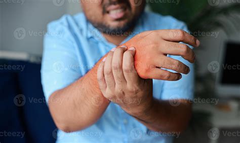 Young man injured his wrist and it was swollen and red. Causes of pain