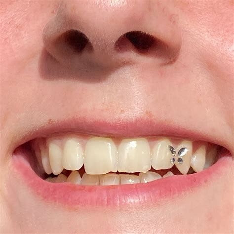 A sparkling smile like a pear with teeth jewelry - drjoshipura