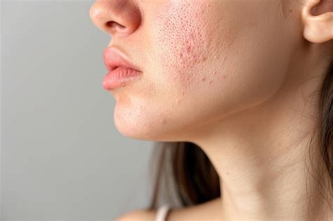 Premium Photo | Allergic skin reaction on the female neck and face