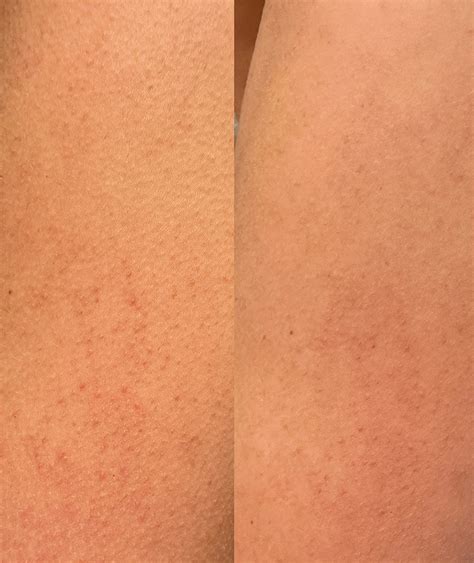 Confidently Clear Body Cleanser