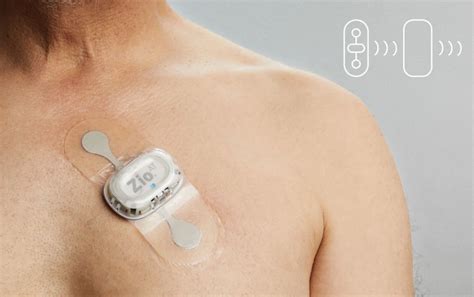 Zio Watch and Paired Software System Earn FDA Nod for AFib Detection ...
