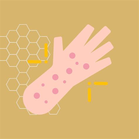 Viral Skin Infections Treatment in Ahmedabad - Dr. Sneha's Skin Solutions