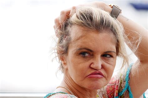 trunu mi kosti lica  desni zbog droge ali  zbog lose izvedene