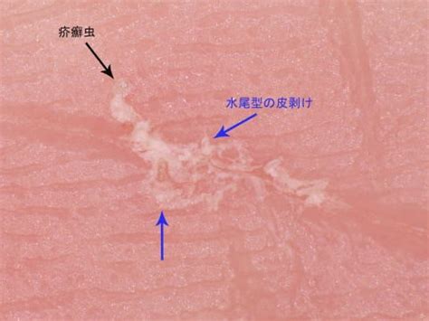 nurshare