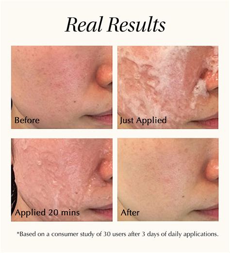 Skin Regeneration Experience Kit