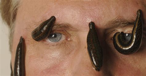 Leeches Meaning