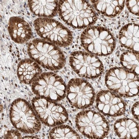 rabbit polyclonal anti tspan antibody buy  research highly