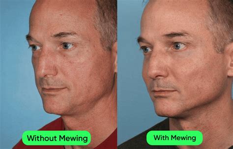 5 Reasons Why Your Cheekbones Could Appear So Big | Mewing.coach