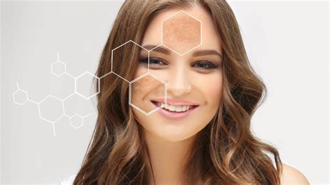 Produtos Para Tirar Manchas Do Rosto Causadas Por Espinhas