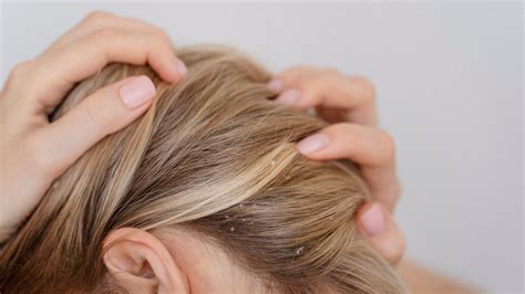 Hair Botox: What is it and is it Worth the Hype? | OnlyMyHealth
