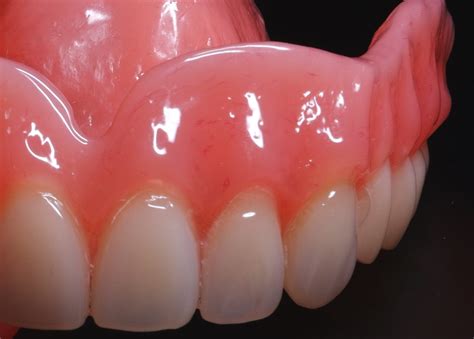 gallery cosmodentbalicom